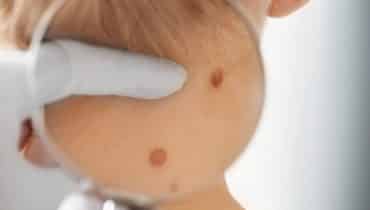 dermatologist near me in brentwood tennessee