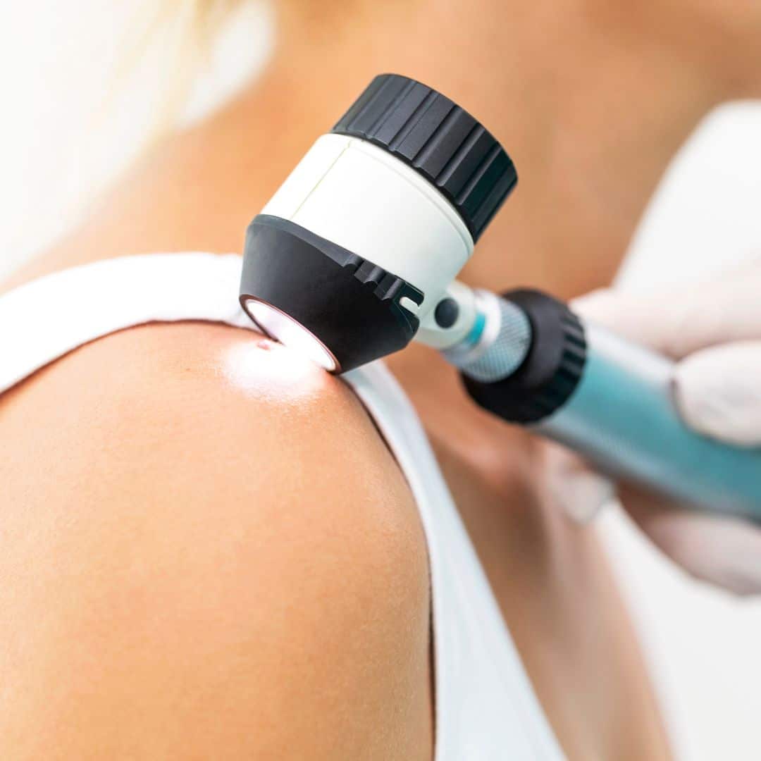 skin cancer doctor in brentwood tn