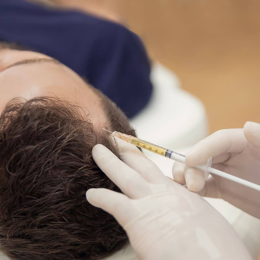 prp hair restoration nashville