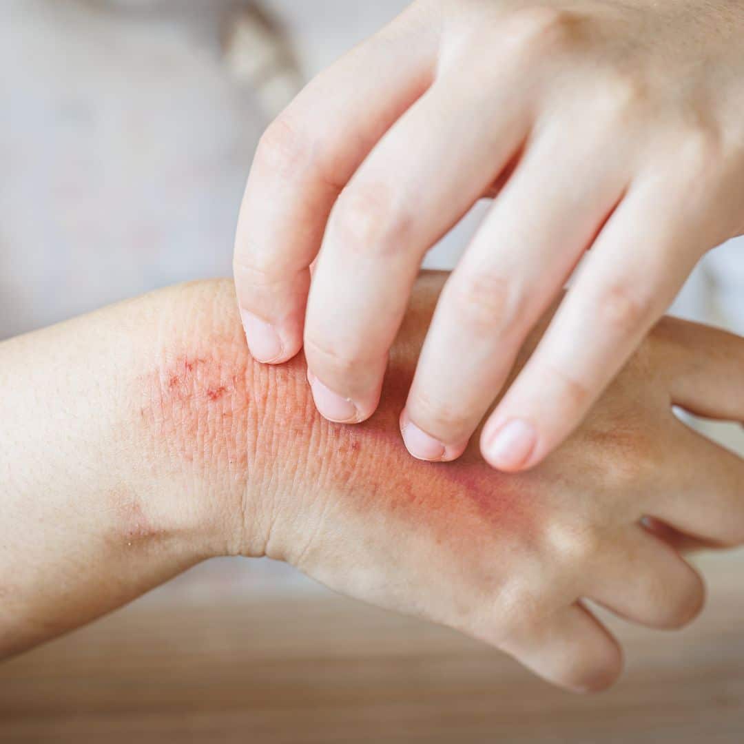 nashville dermatologist for skin infections