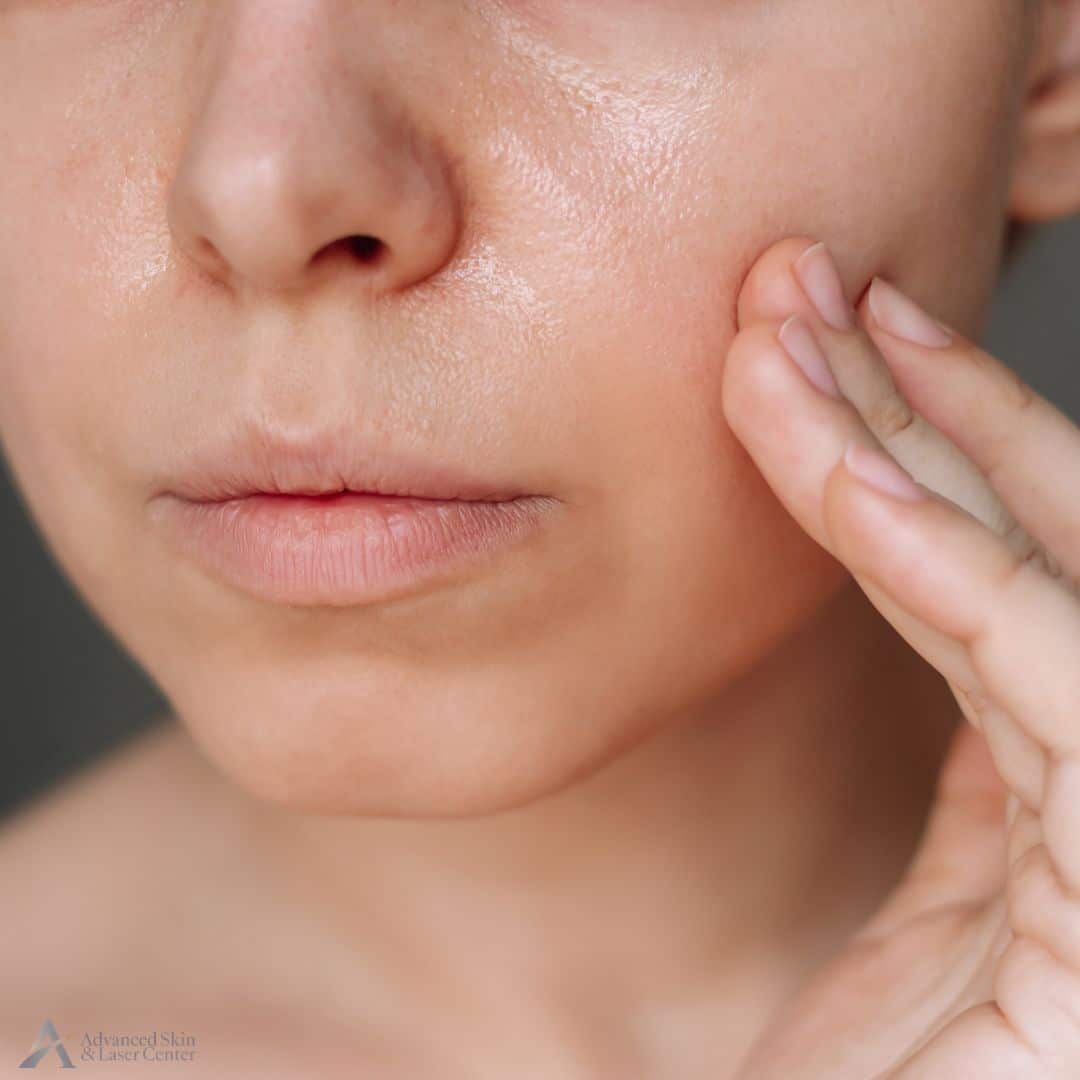 laser skin treatments in brentwood tn