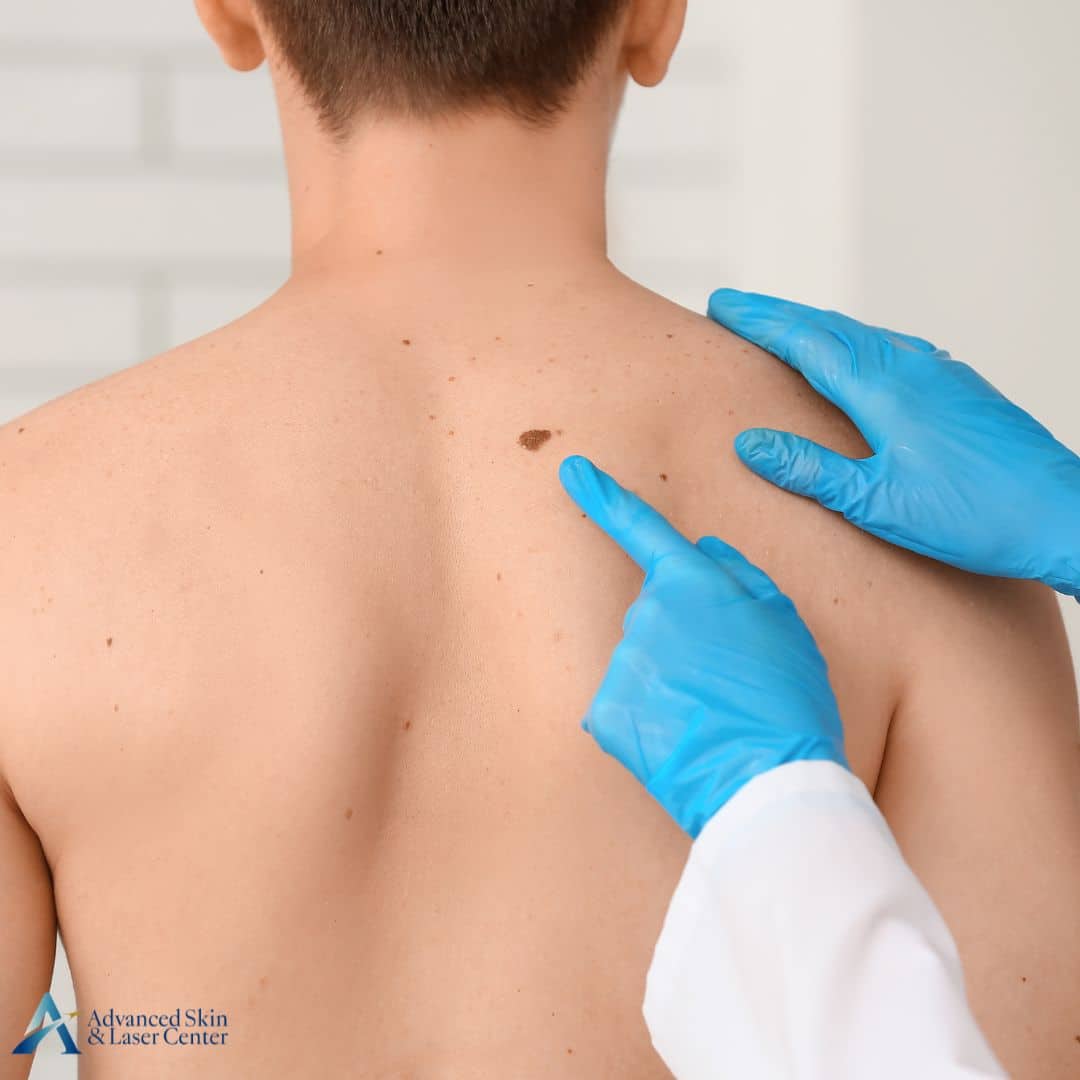 dermatologist in antioch tn