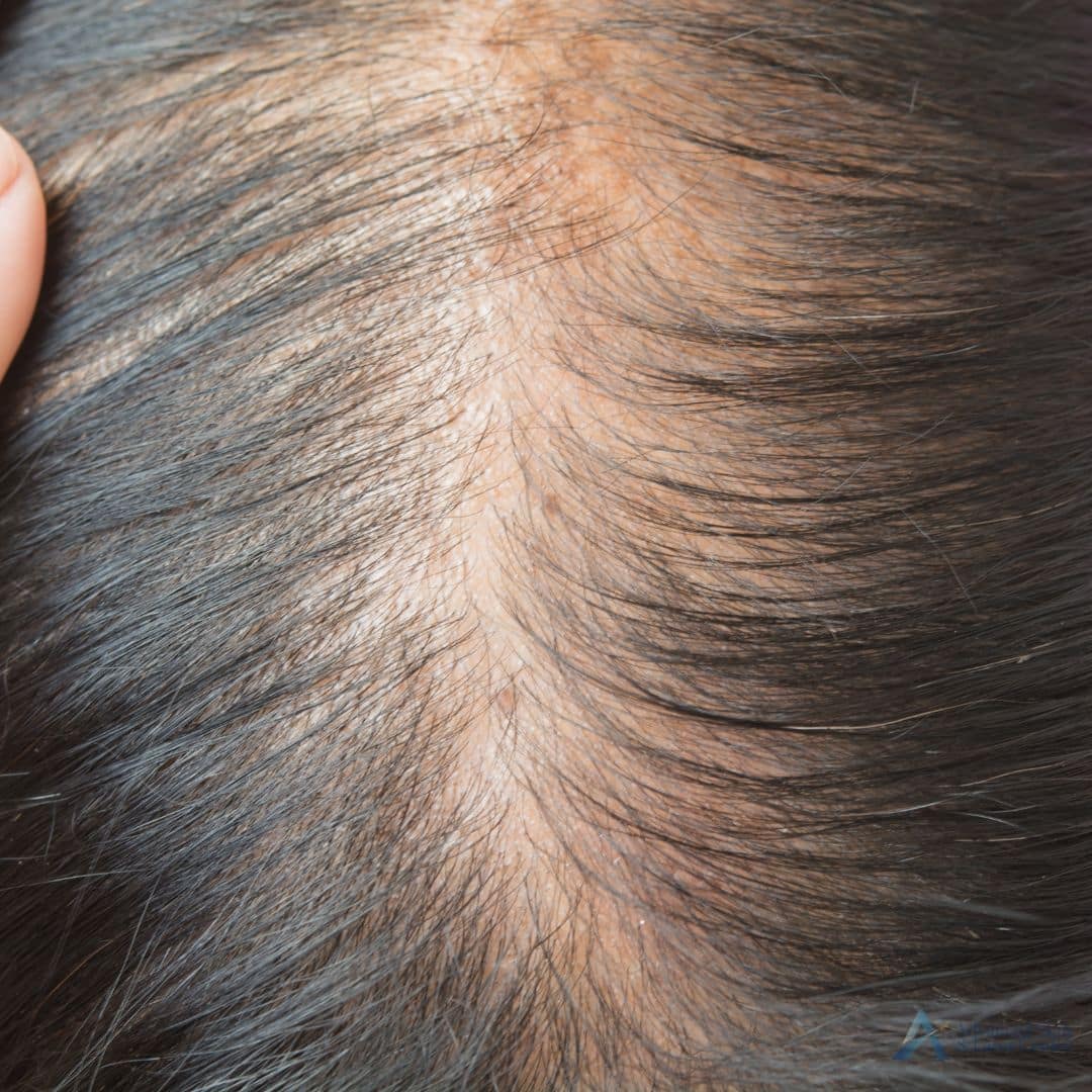 hair dermatologist nashville