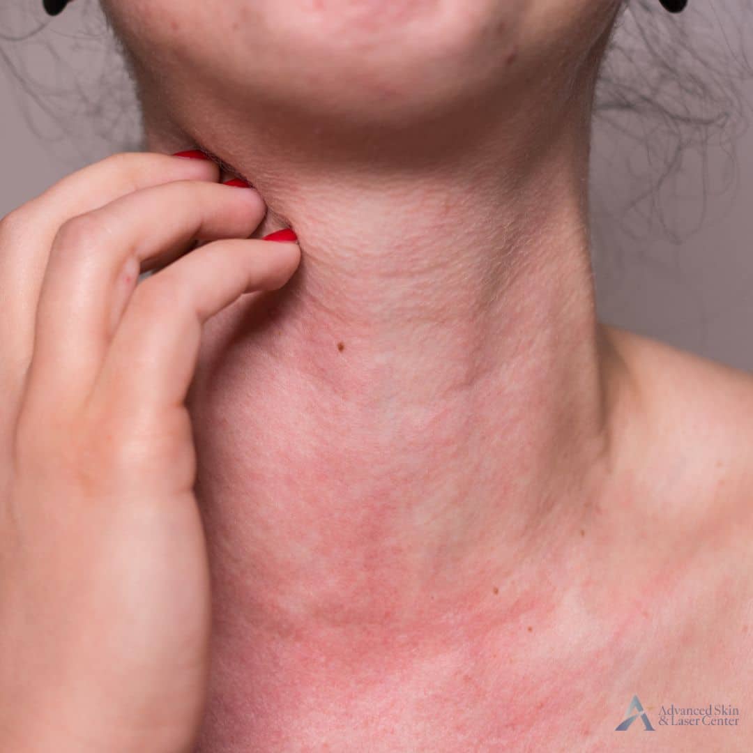 skin allergy doctor brentwood tn